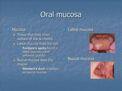 mucosa oral - oral b gingivitis